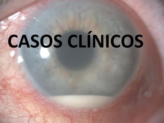 CASOS CLÍNICOS
 