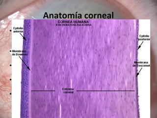 Anatomía corneal
• Epitelio: 1/10 parte del grosor corneal total. Gran
capacidad de regeneración no forma cicatriz tras
ser lesionado
• Membrana de Bowman: estructura acelular. No
se regenera.
• Estroma: 90% del grosor cornal. Compuesto
principalmente de colágeno
• Membrana Descement: lámina basal del
endotelio de la córnea.
• Endotelio: una sola capa de células. Se encarga
del mantenimiento de la trasparencia corneal
 