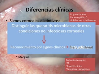 Diferencias clínicas
• Signos corneales distintivos:
– Estado del epitelio (ulcerado o intacto)
– Tipo de inflamación estromal (supurativa o no)
– Localización de inflamacion
• Focal
• Difusa
• Multifocal
• Marginal
¿Qué
microorganismos
penetran en epitelio
corneal intacto?
N. gonorrhoeae,
N.meningitidis, C.
diphtheriae, H. influenzae,
L. monocytogenes
Examen de laboratorio
Tratamiento según:
•FR
•Aspecto clínico
•Potenciales patógenos
Queratitis supurada
asociada a conjuntivitis
purulenta
Distinguir las queratitis microbianas de otras
condiciones no infecciosas corneales
Reconocimiento por signos clínicos Reto adicionalReto adicional
 