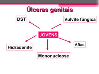 Úlceras genitais
DST

Vulvite fúngica
JOVENS
Aftas

Hidradenite
Mononucleose

 