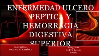 ENFERMEDAD ULCERO
PEPTICA Y
HEMORRAGIA
DIGESTIVA
SUPERIOR
Integrante
ALF/V Lucero
Loreto
Instructora
DRA. NELLY RAMÍREZ
 