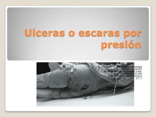 Ulceras o escaras por
presión
Modulo Gerontología
Primera Rotación
Alumna: Solange Venegas Lara.
Medicina IV año
Universidad Mayor Temuco
2013
 