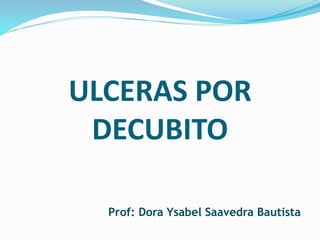 ULCERAS POR
DECUBITO
Prof: Dora Ysabel Saavedra Bautista
 