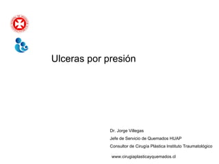 Ulceras por presión Dr. Jorge Villegas Jefe de Servicio de Quemados HUAP Consultor de Cirugía Plástica Instituto Traumatológico www.cirugiaplasticayquemados.cl 