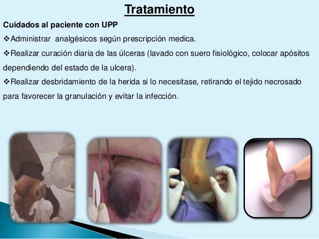 definicion de hipertensión arterial con el estrés