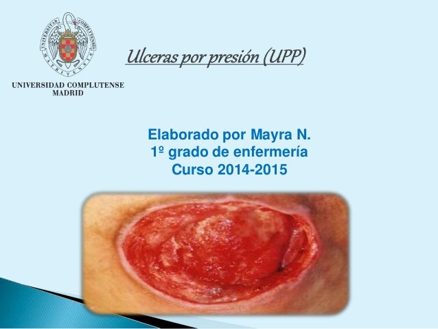 Prueba hipertensión refractaria