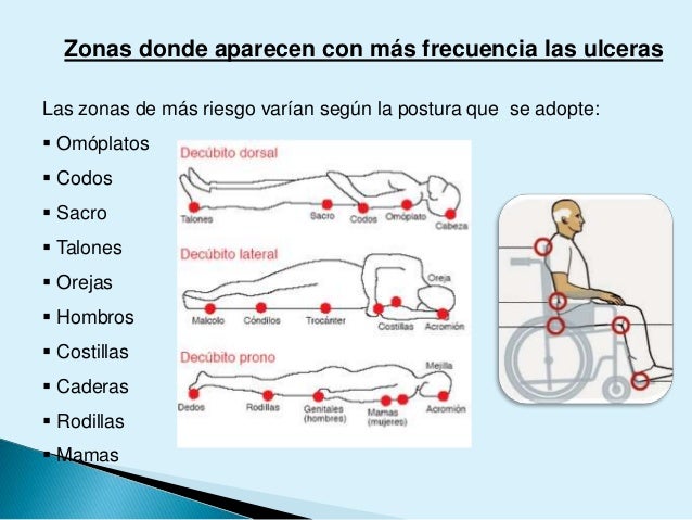 La mejor solución para hipertensión arterial sistemica