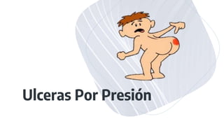 Ulceras Por Presión
 