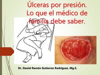 Úlceras por presión.
Lo que el médico de
familia debe saber.
Dr. Daniel Ramón Gutierrez Rodríguez. Mg.S.
 