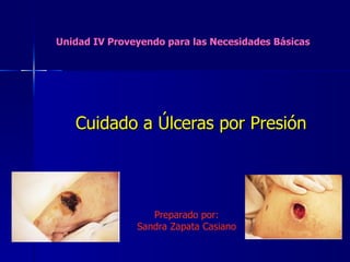 Unidad IV Proveyendo para las Necesidades Básicas Cuidado a Úlceras por Presión Preparado por: Sandra Zapata Casiano 
