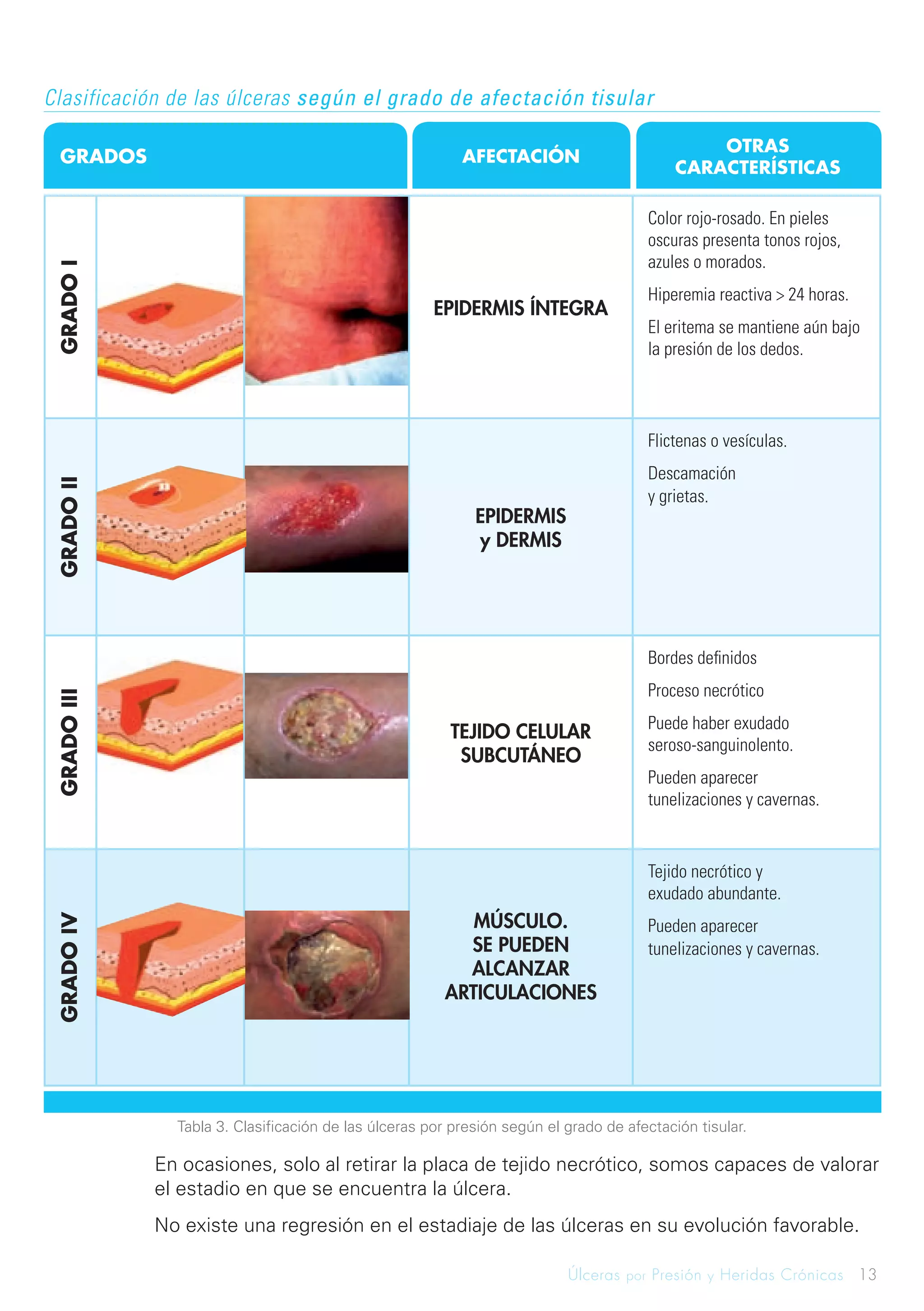 Ulceras por presion y heridas cronicas | PDF