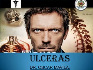 ULCERAS
DR. OSCAR MAVILA.
 