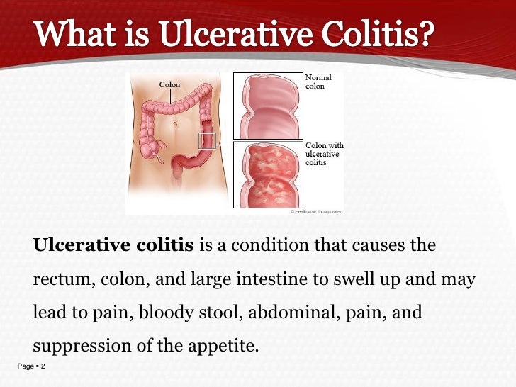 Collitis Dog Home Remedy Collitis Dog Home Remedy