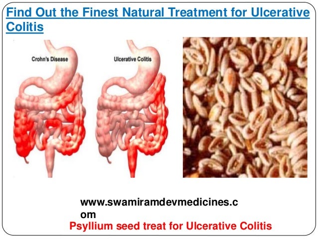 Find Out the Finest Natural Treatment for Ulcerative Colitis