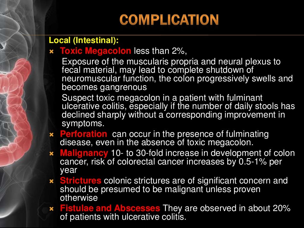 Ulcerative Colitis