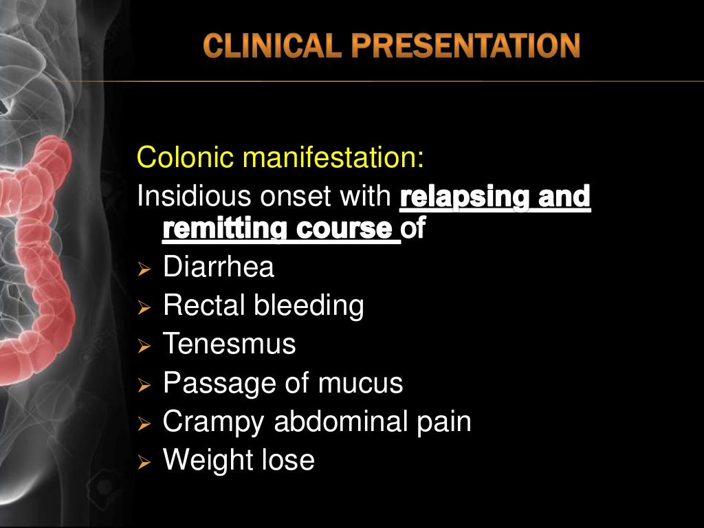 Ulcerative Colitis