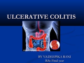 ULCERATIVE COLITISULCERATIVE COLITIS
BY V.S.DEEPIKA RANIBY V.S.DEEPIKA RANI
B.Sc Final yearB.Sc Final year
 