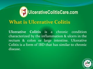 What is Ulcerative Colitis
Ulcerative Colitis is a chronic condition
characterized by the inflammation & ulcers in the
rectum & colon or large intestine. Ulcerative
Colitis is a form of IBD that has similar to chronic
disease.
 