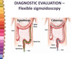 ULCERATIVE COLITIS | PPTX