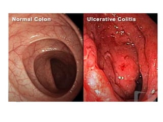 Seminar on mgt of UC
 