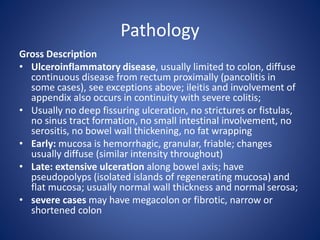 Ulcerative colitis explanation, management and therapy | PPTX