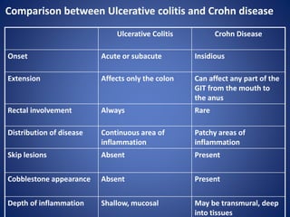 Ulcerative colitis explanation, management and therapy | PPTX