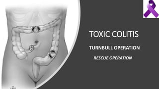 TOXIC COLITIS
TURNBULL OPERATION
RESCUE OPERATION
 