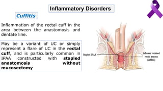 Inflammatory Disorders
Cuffitis
Inflammation of the rectal cuff in the
area between the anastomosis and
dentate line.
May be a variant of UC or simply
represent a flare of UC in the rectal
cuff, and is particularly common in
IPAA constructed with stapled
anastomosis without
mucosectomy
 
