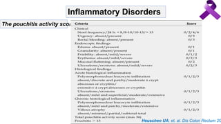 Inflammatory Disorders
The pouchitis activity score
Heuschen UA, et, al. Dis Colon Rectum 20
 