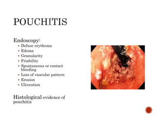 Endoscopy:
 Defuse erythema
 Edema
 Granularity
 Friability
 Spontaneous or contact
bleeding
 Loss of vascular pattern
 Erosion
 Ulceration
Histological evidence of
pouchitis
 