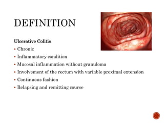 Ulcerative Colitis
 Chronic
 Inflammatory condition
 Mucosal inflammation without granuloma
 Involvement of the rectum with variable proximal extension
 Continuous fashion
 Relapsing and remitting course
 
