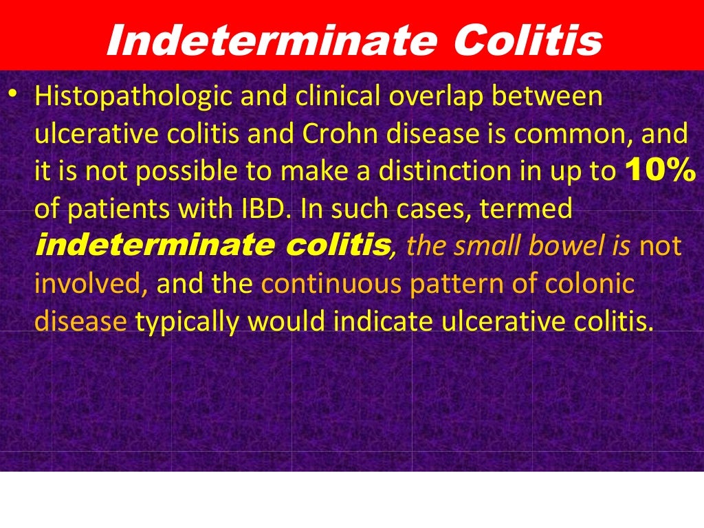 Ulcerative colitis, classification, causes,clinical features, morphol…