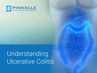 Understanding
Ulcerative Colitis
 