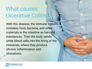 What causes
Ulcerative Colitis?
With this disease, the immune system
mistakes food, bacteria, and other
materials in the intestine as harmful
substances. Then the body sends
white blood cells into the lining of the
intestines, where they produce
chronic inflammation and
ulcerations.
 