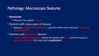 Pathology: Macroscopic features
• Remission
• Mucosa may appear normal
• Patients with many years of disease
• Appears atrophic and featureless, and the entire colon becomes narrowed
and shortened
• Patients with fulminant disease
• a toxic colitis or megacolon where the bowel wall thins and the mucosa is
severely ulcerated; this may lead to perforation
 