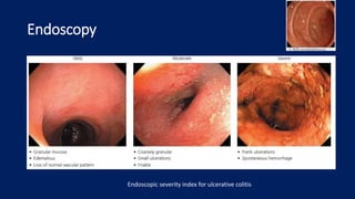 Endoscopy
Endoscopic severity index for ulcerative colitis
 