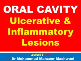 ORAL CAVITY
Ulcerative &
Inflammatory
Lesions

Lecture 1 New
By Dr Mohammad Manzoor Mashwani

 