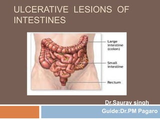 ULCERATIVE LESIONS OF
INTESTINES

Dr.Saurav singh
Guide:Dr.PM Pagaro

 