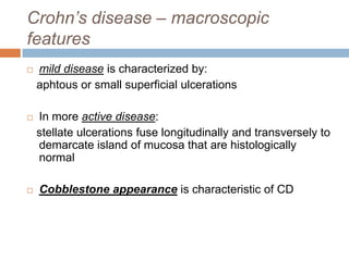 Crohn’s disease – macroscopic
features


mild disease is characterized by:
aphtous or small superficial ulcerations



In more active disease:
stellate ulcerations fuse longitudinally and transversely to
demarcate island of mucosa that are histologically
normal



Cobblestone appearance is characteristic of CD

 