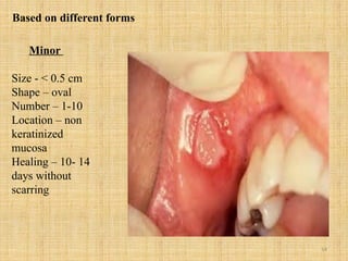 14
Minor
Size - < 0.5 cm
Shape – oval
Number – 1-10
Location – non
keratinized
mucosa
Healing – 10- 14
days without
scarring
Based on different forms
 