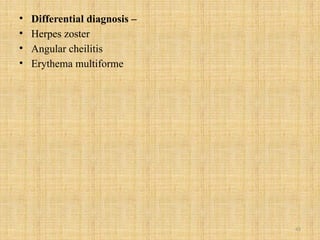 45
• Differential diagnosis –
• Herpes zoster
• Angular cheilitis
• Erythema multiforme
 
