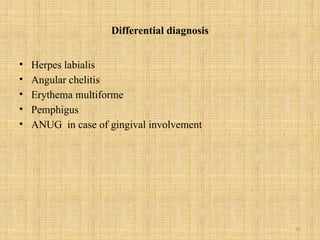 55
Differential diagnosis
• Herpes labialis
• Angular chelitis
• Erythema multiforme
• Pemphigus
• ANUG in case of gingival involvement
 