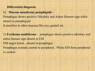 68
Differential diagnosis
1) Mucous membrane pemphigoid –
Pemphigus shows positive Nikolsky and Asboe Hensen sign while
absent in pemphigoid
It manifest in other mucous like eye, genital etc.
2) Erythema multiforme - pemphigus shows positive nikolsky and
asboe hensen sign absent in EM
EM target lesion , absent in pemphigus
Pemphigus extends central to peripheral . While EM from peripheral
to central.
 