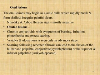 74
Oral lesions
The oral lesions may begin as classic bulla which rapidly break &
form shallow irregular painful ulcers.
• Nikolsky & Asboe Hensen sign – mostly negative
• Ocular lesions –
• Chronic conjuctivitis with symptoms of burning, irritation ,
photophobia and excess tearing.
• Vesicles & ulcerations is seen only in advances stage.
• Scarring following repeated fibrosis can lead to the fusion of the
bulbar and palpebral conjuctivae(symblepharon) or the superior &
inferior palpebrae (Ankyoblepharon)
 