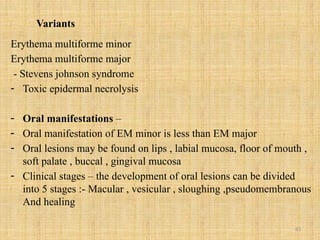 83
Variants
Erythema multiforme minor
Erythema multiforme major
- Stevens johnson syndrome
- Toxic epidermal necrolysis
- Oral manifestations –
- Oral manifestation of EM minor is less than EM major
- Oral lesions may be found on lips , labial mucosa, floor of mouth ,
soft palate , buccal , gingival mucosa
- Clinical stages – the development of oral lesions can be divided
into 5 stages :- Macular , vesicular , sloughing ,pseudomembranous
And healing
 