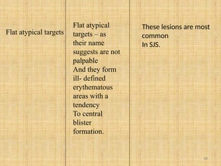 88
Flat atypical targets
Flat atypical
targets – as
their name
suggests are not
palpable
And they form
ill- defined
erythematous
areas with a
tendency
To central
blister
formation.
These lesions are most
common
In SJS.
 