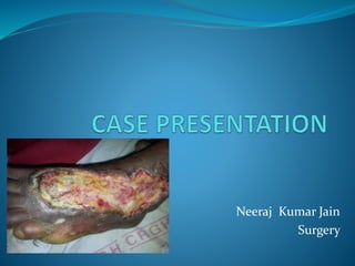 Neeraj Kumar Jain
Surgery
 