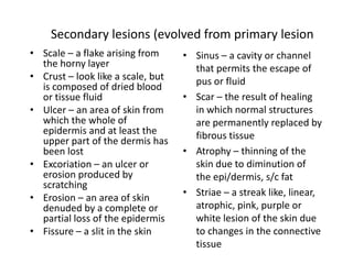 Secondary lesions (evolved from primary lesion
• Scale – a flake arising from
the horny layer
• Crust – look like a scale, but
is composed of dried blood
or tissue fluid
• Ulcer – an area of skin from
which the whole of
epidermis and at least the
upper part of the dermis has
been lost
• Excoriation – an ulcer or
erosion produced by
scratching
• Erosion – an area of skin
denuded by a complete or
partial loss of the epidermis
• Fissure – a slit in the skin
• Sinus – a cavity or channel
that permits the escape of
pus or fluid
• Scar – the result of healing
in which normal structures
are permanently replaced by
fibrous tissue
• Atrophy – thinning of the
skin due to diminution of
the epi/dermis, s/c fat
• Striae – a streak like, linear,
atrophic, pink, purple or
white lesion of the skin due
to changes in the connective
tissue
 