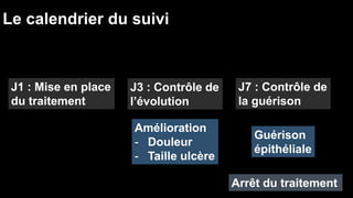 Le calendrier du suivi 
J1 : Mise en place 
du traitement 
J3 : Contrôle de 
l’évolution 
J7 : Contrôle de 
la guérison 
Amélioration 
- Douleur 
- Taille ulcère 
Guérison 
épithéliale 
Arrêt du traitement 
 