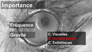 Importance 
Fréquence 
Gravité C. Visuelles 
C. Douloureuses 
C. Esthétiques 
 